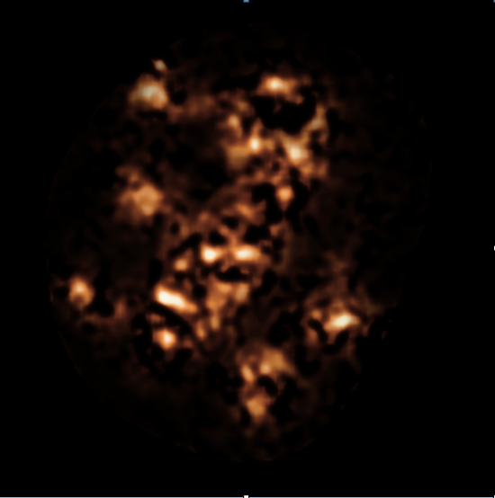 Original caption: This image shows the APEX view in sub-millimetre light of the region around the Spiderweb Galaxy— a protocluster of galaxies in the early Universe surrounding a radio galaxy containing a supermassive black hole. Some of the blobs in this image correspond to dusty star-forming galaxies in the protocluster that cannot be seen in visible light due to absorption by dust. The fainter features here are artifacts of the difficult APEX image processing. Credit: ESO