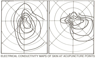 Thunderblog 3 acupoints by Alex Fournier 1